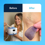 Load image into Gallery viewer, Waxing Kit for Women Men Hard Wax Kit for Hair Removal Wax Warmer All in One