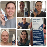 Load image into Gallery viewer, Psoriasis Scalp Spray Dandruff Spray with Salicylic Acid 3% Treatment for Flaking Itching & Dryness Fast Absorbing Scalp Relief for Dandruff Folliculitis Seborrheic Dermatitis & Eczema