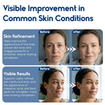 Load image into Gallery viewer, Glycolic Acid Pads Resurfacing Pads for Face 20% Exfoliating Peel Pad for Body and Dark Spots Fine Lines and Wrinkles 60 Count