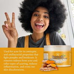 Load image into Gallery viewer, Yadain Turmeric Aloe Whipped Shea Body Butter Shea Butter for Face and Body