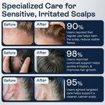 Load image into Gallery viewer, Psoriasis Scalp Spray Dandruff Spray with Salicylic Acid 3% Treatment for Flaking Itching & Dryness Fast Absorbing Scalp Relief for Dandruff Folliculitis Seborrheic Dermatitis & Eczema
