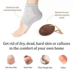 Load image into Gallery viewer, Pumice Stone for Feet & Moisturizing Heel Sleeves Natural Lava Foot Stone Callus Removing Set Cracked Heel Treatment Foot Care Kit for Dry Cracked Feet Body Hands