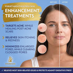 Load image into Gallery viewer, Niacinamide Serum 8Oz for Face 10% with Zinc 1% Vitamin B3 Brightening Serum