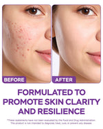Load image into Gallery viewer, Dim Supplement 370mg Complex with Zinc Niacinamide Estrogen Blocker for Women & Men Hormone Balance Hormonal Acne Menopause and Antioxidant Support Diindolylmethane 30 Capsules