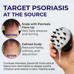 Load image into Gallery viewer, Scalp Psoriasis Shampoo Flakes Anti Dandruff Itchy Scalp Treatment for Seborrheic Dermatitis & Folliculitis Anti Fungal Medicated Solution for Itchy Flaky & Dry Hairs