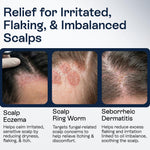 Load image into Gallery viewer, Psoriasis Scalp Spray Dandruff Spray with Salicylic Acid 3% Treatment for Flaking Itching & Dryness Fast Absorbing Scalp Relief for Dandruff Folliculitis Seborrheic Dermatitis & Eczema