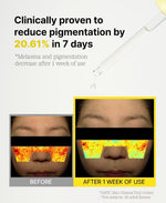 Load image into Gallery viewer, 3% TXA Vitamin Serum for Face Brightening Vitamin Serum 1.01 fl.oz for Dark Spots and Uneven Skin Tone
