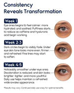 Load image into Gallery viewer, Under Eye Cream for Puffiness and Bags Under Eyes 1 fl oz Eye Bags Treatment for Men Women Anti Wrinkle Cream for Dark Circles Baggy Eyes Treatment for Women with Retinol Hyaluronic Acid &amp; Caffeine