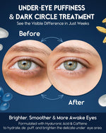 Load image into Gallery viewer, Under Eye Cream for Puffiness and Bags Under Eyes 1 fl oz Eye Bags Treatment for Men Women Anti Wrinkle Cream for Dark Circles Baggy Eyes Treatment for Women with Retinol Hyaluronic Acid &amp; Caffeine