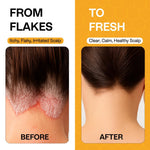 Load image into Gallery viewer, Psoriasis Shampoo for Dry Itchy Scalp Psoriasis Scalp Treatment for Eczema Relief Seborrheic Dermatitis Ringworm &amp; Folliculitis Itchy Scalp Shampoo for Flakes Acne with Manuka Honey