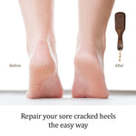 Load image into Gallery viewer, Pumice Stone Foot Brush Scrubber Wooden Pedicure Foot File with Handle for Dry Dead Skin Corn &amp; Callus Remover for Feet Foot Scraper Exfoliating Brush for Heels Elbows Hands
