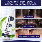 Load image into Gallery viewer, Scalp Psoriasis Shampoo Flakes Anti Dandruff Itchy Scalp Treatment for Seborrheic Dermatitis &amp; Folliculitis Anti Fungal Medicated Solution for Itchy Flaky &amp; Dry Hairs