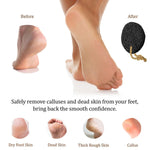 Load image into Gallery viewer, Pumice Stone   Natural Earth Lava Pumice Stone Black   Callus Remover for Feet
