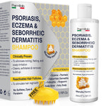 Load image into Gallery viewer, Psoriasis Shampoo for Dry Itchy Scalp Psoriasis Scalp Treatment for Eczema Relief Seborrheic Dermatitis Ringworm &amp; Folliculitis Itchy Scalp Shampoo for Flakes Acne with Manuka Honey