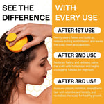 Load image into Gallery viewer, Psoriasis Shampoo for Dry Itchy Scalp Psoriasis Scalp Treatment for Eczema Relief Seborrheic Dermatitis Ringworm &amp; Folliculitis Itchy Scalp Shampoo for Flakes Acne with Manuka Honey